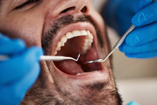 Best Emergency Dental Care for Abscessed Tooth in Mansfield, OH