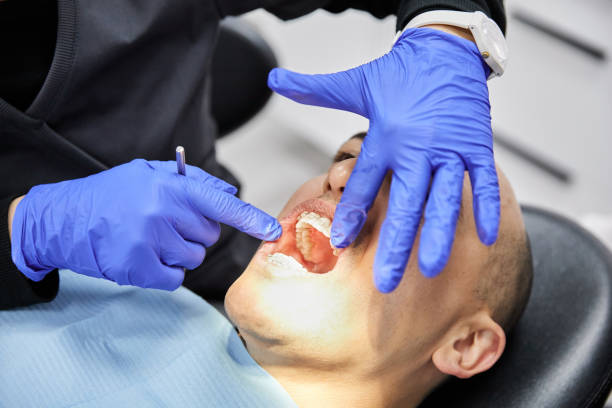 Best Emergency Dentist for Knocked-Out Tooth in Mansfield, OH