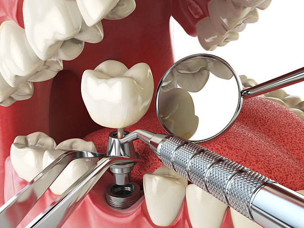 Best Weekend Emergency Dentist in Mansfield, OH